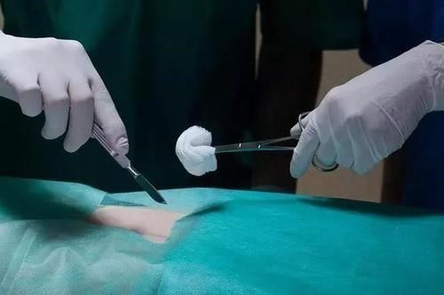 电刀|为什么做手术切那么大的口子不出血,切菜被刀划一下就血流不止