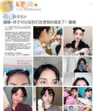 后天|宝宝头发浓密成“万人迷”：怎样才能让娃的发量在后天有所增长呢