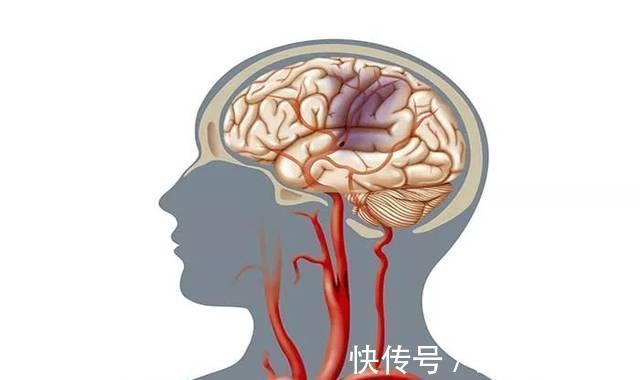 热水泡脚|脑供血不足了别担心,7招教你改善脑供血不足