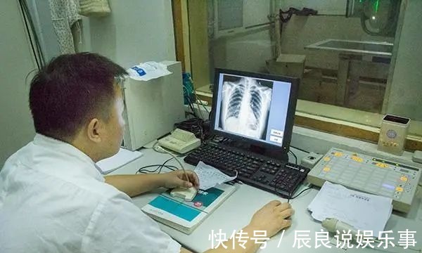 医生|夫妻俩先后查出肺癌，医生：手部早就给出提醒，却没及时发觉