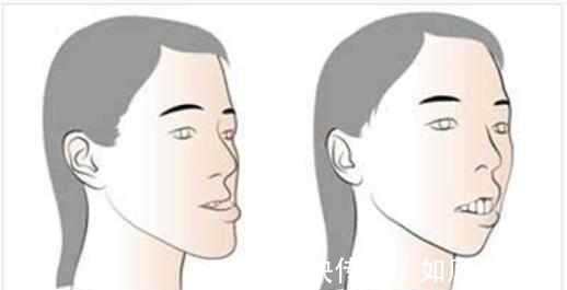 正畸|儿童做牙齿矫正三个最佳时间家长要牢记,矫治越早干预效果越好