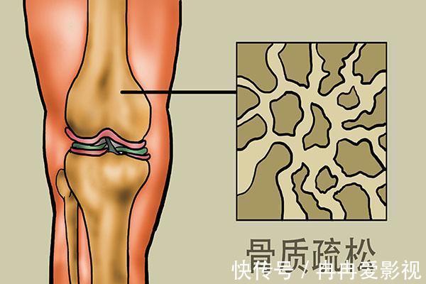 老年人|老年人摔一跤，结果有多严重？60岁以后，3种食物要舍得吃