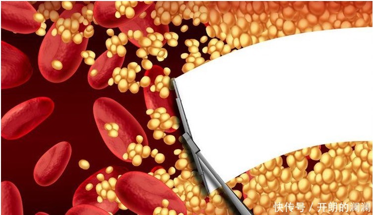 经常吃腐乳的人，最后都怎么样了 5种病从来没得过！