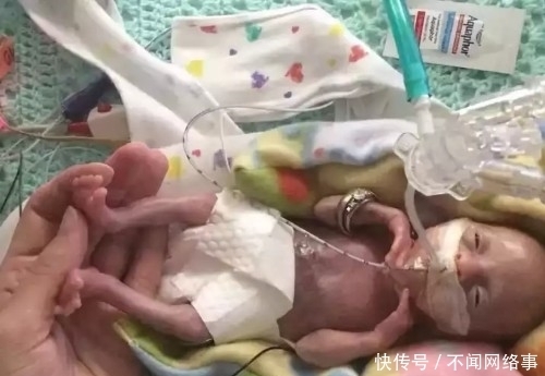 库内|他用将死的早产儿供人观赏赚钱,引来无数谩骂,死后却备受推崇