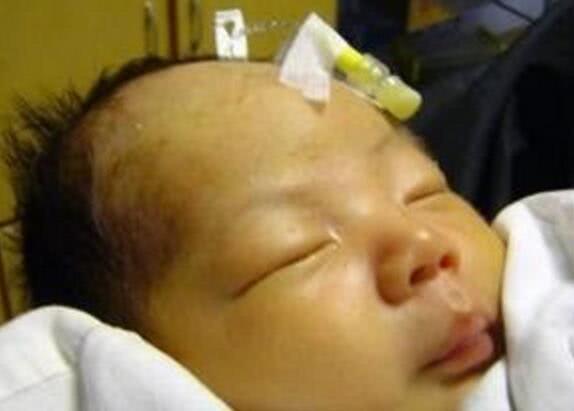 坏习惯|孩子出生后出现黄疸,多半是孕期时的坏习惯导致,要留心!