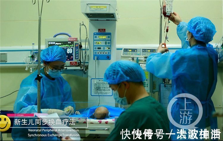 胆红素|“熊猫血”宝宝出生仅两天 换了四次血终于救回来了!