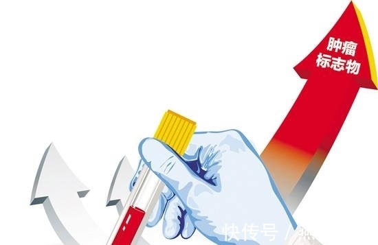 肿瘤标志物|辟谣!肿瘤标志物升高就一定是癌症吗?答案没那么简单