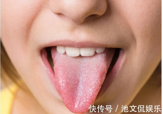 舌头是一张健康晴雨表，好坏都写在它身上，癌症也是