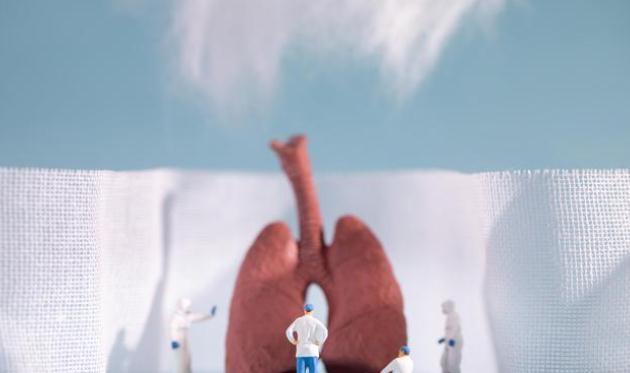 结节|如何让你的肺结节变小甚至消失?听听医生怎么说