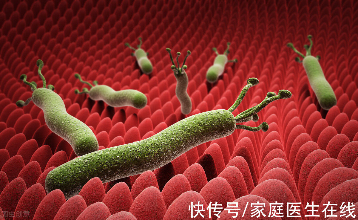感染幽门螺杆菌|感染幽门螺杆菌就一定会患胃癌？别慌，没那么可怕，谨记这些常识
