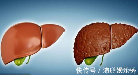 黄花草油酸|89岁朱晓东院士提醒:若血脂升高,这2种素食要尽量少吃,应牢记