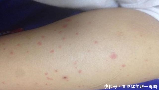 妈妈|继毒童鞋、毒纸巾后,“毒童装”再被曝光,很多妈妈花高价购买