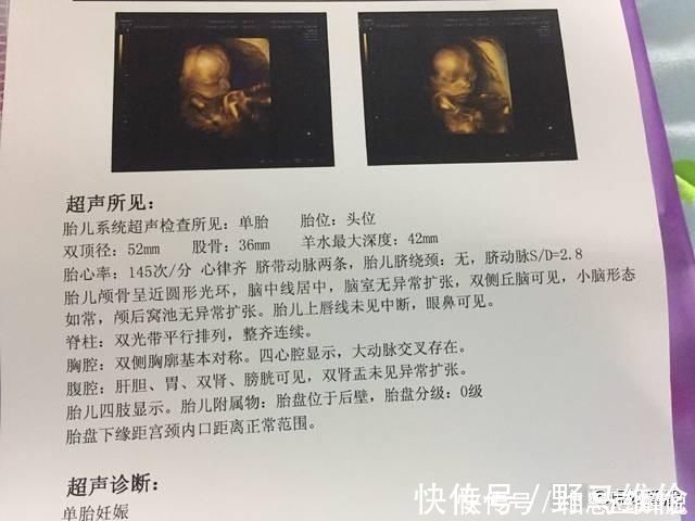 宝宝|怀孕后,这2项孕期检查千万别忘了做,关系到胎儿的健康