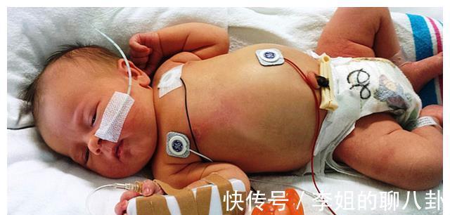 婆婆|孕妈怀孕35周腹痛剧烈,剖腹产生下“绿娃娃”,医生怒斥:太无