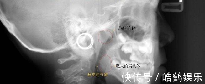 老婆|3岁女儿越长越像猴子,老公怀疑老婆以前整容,查出原因家人凌乱!