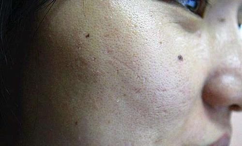 女性|女性荷尔蒙旺盛,与正常人有什么区别提升荷尔蒙,该怎么做