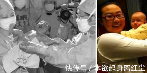 西京学院|32年过去了，中国首例“试管婴儿”已经长大生子，如今怎样了