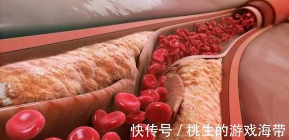 大鱼大肉|血脂高的人要少吃粗粮？医生：若不想血脂升高，2种粗粮尽量少吃