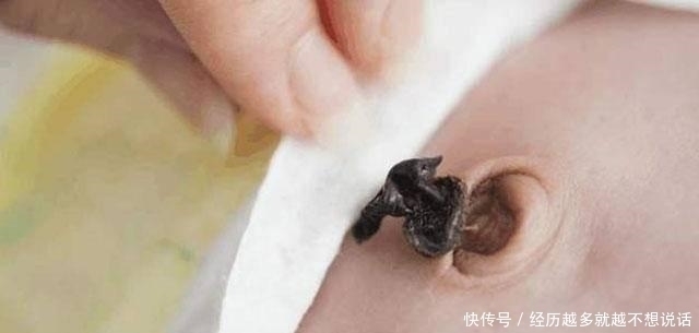 脐带|肚脐眼能不能抠?喜欢抠肚脐眼的孩子,你们知道后果会是怎样吗?