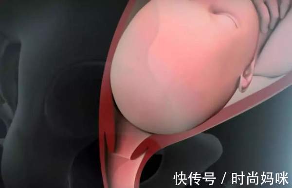 阵痛|分娩时宝宝也在用力吗?你痛的死去活来的时候,看看宝宝在做什么!