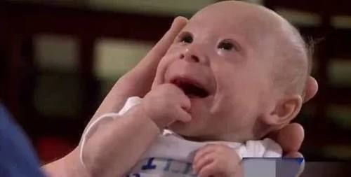 婴儿|婴儿刚出生就被判侏儒症停止发育,父母不愿放弃如今变成这样!