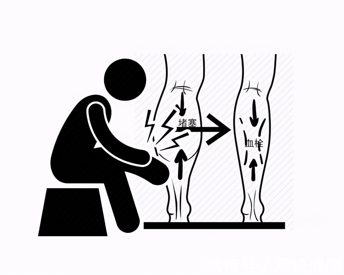 二郎腿|高雅?帅气?有风度?跷二郎腿,在医生的眼中:好处只有一个