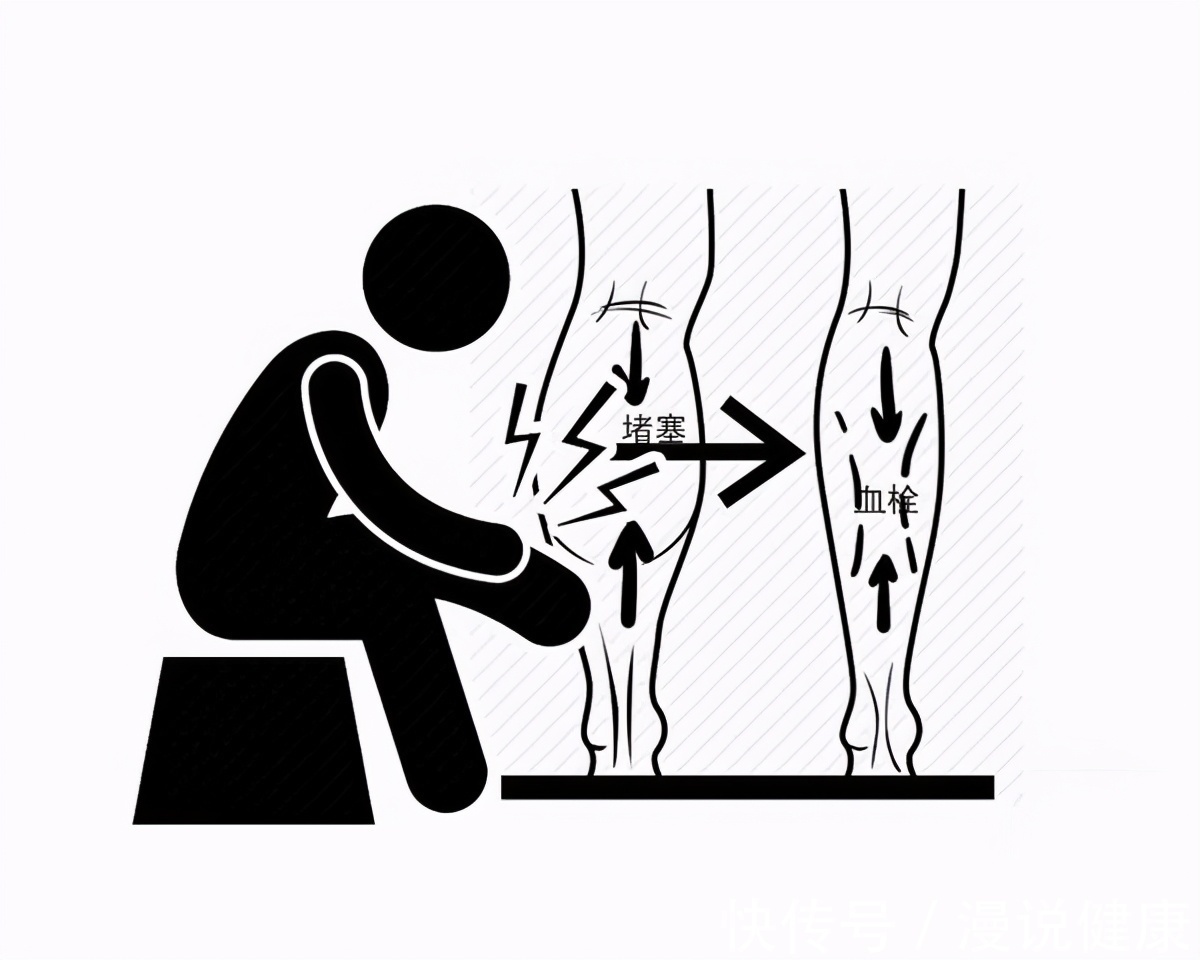 二郎腿|高雅？帅气？有风度？跷二郎腿，在医生的眼中：好处只有一个