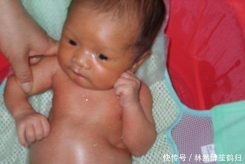 医生|出生刚9个月，宝宝肚子鼓的像“圆球”，医生检查后怒斥家长