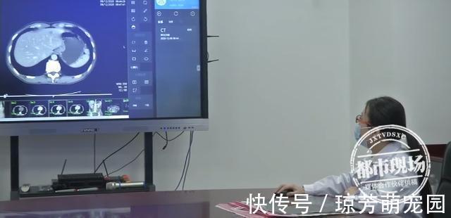 警醒|女子年年体检“正常”,却被诊断为癌症晚期,医生一句话让众人警醒