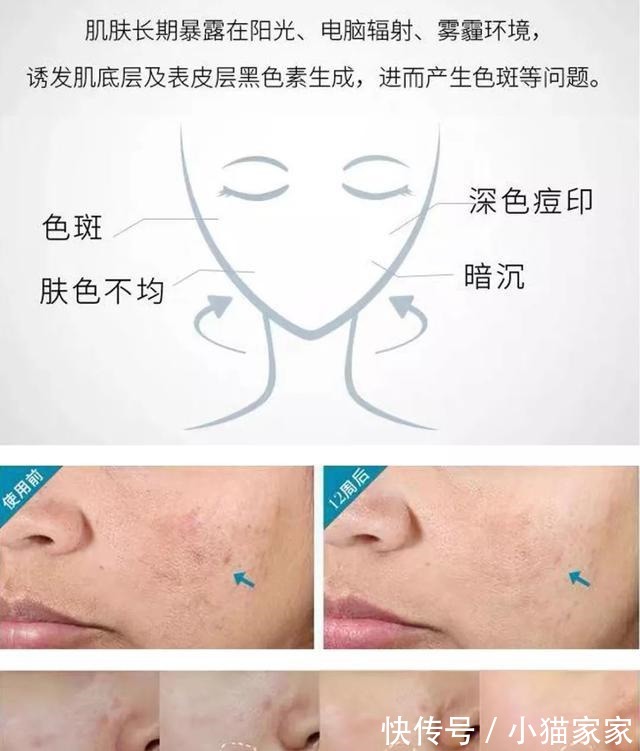 护肤品 哪些皮肤问题是护肤品不能解决的!