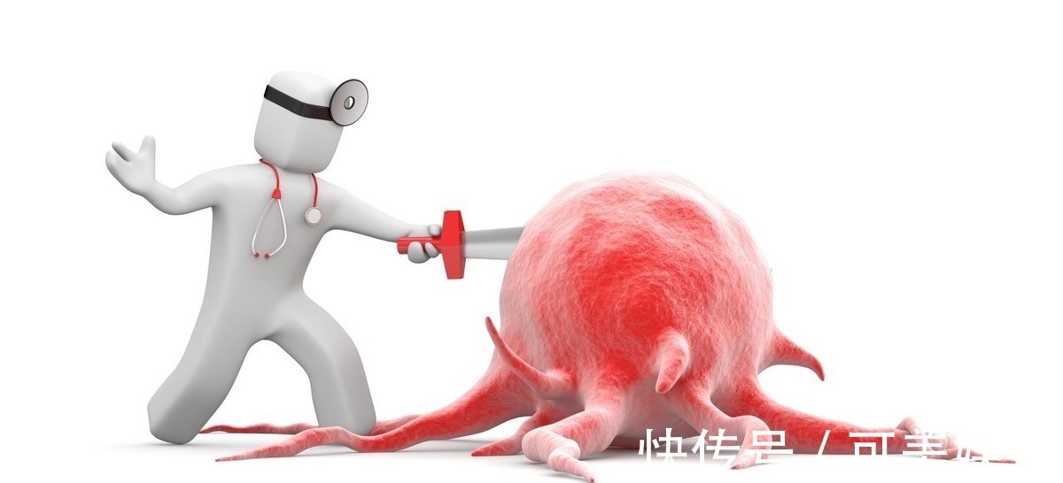 副作用|男性也会患乳腺癌，没有远处转移也有根治机会，大多数可以活得久