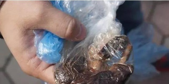 妈妈|剖腹产后没多久,肚子竟还是大如球,医生再次手术时也惊出一身汗