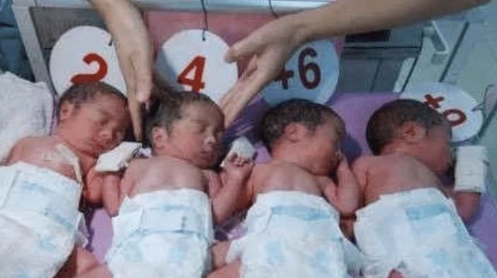 宝妈|四胞胎一模一样,上学老师分不出,宝妈一波操作,老师一目了然