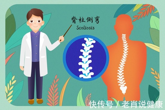 脊柱|尚医脊道:颈椎病是“小事情”?引发的高概率并发症,可不能小瞧 !