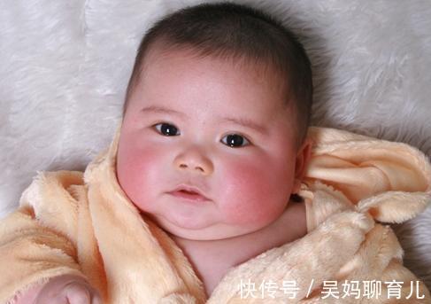 球球|1岁男孩总湿疹，经检查是脾虚，家长3个行为是祸首
