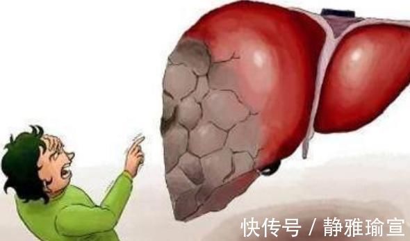 安眠茶|肝毒都是慢慢“攒成”的,4种坏习惯不纠正,会悄悄地“伤肝”!