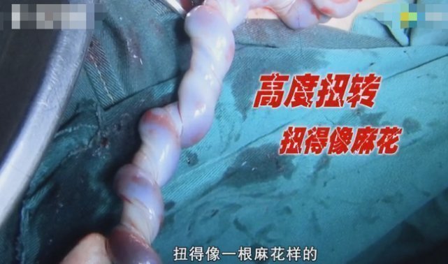 弧线|孕36周后,孕妈有这2种怪怪的“变化”,恭喜你,是胎儿入盆了