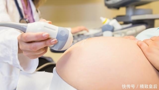 有假|宫缩也有假?怎么判断?