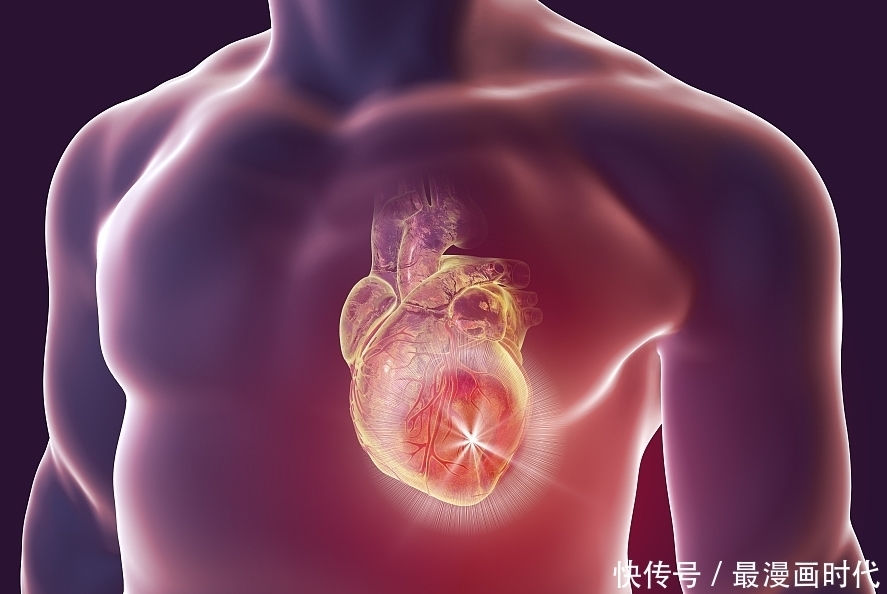 心脑血管疾|心梗“偏爱”6大人群!提醒:注意5个表现,别让心梗“钻空子”