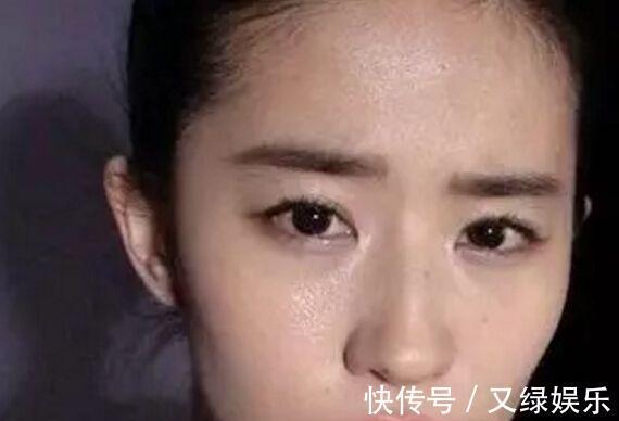 失眠|熬夜之后头疼失眠很普遍,医生4种熬夜后遗症,劝你都不要忽视