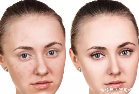 长黑头了?如何预防和去除黑头,使皮肤光滑明亮,看看就知道了!