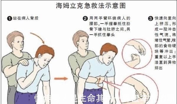 写作业|“去医院就晚了!”11岁儿子被卡喉,宝妈2个“果断”救孩子一命