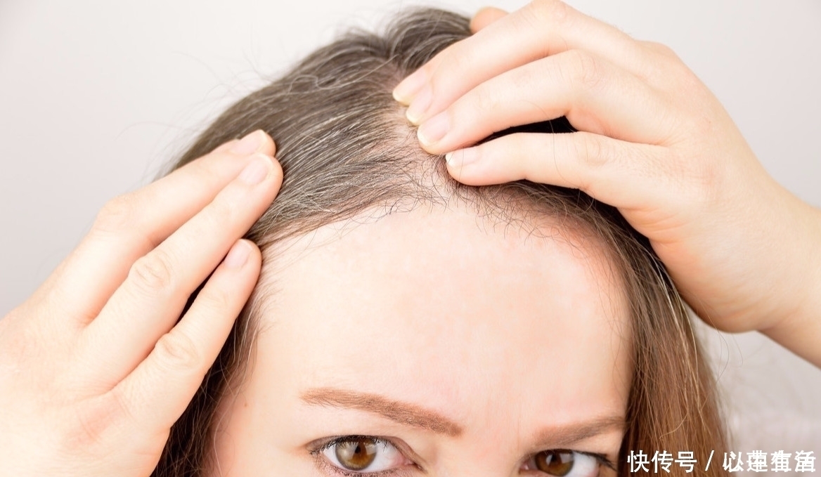 白發|“桂圓”煮著吃,頭發一天好過一天,白發沒了,染發錢都省了