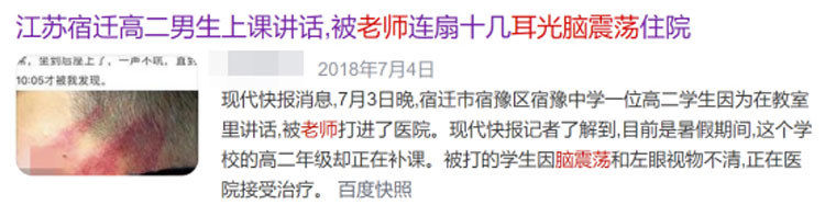 颅骨|大脑又软又糯，为什么我们可以摇晃翻滚，脑子不会烂成一团？