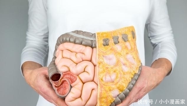 药都|一天8杯水还便秘,肠道很干燥,水里加2物留住肠道水分不便秘