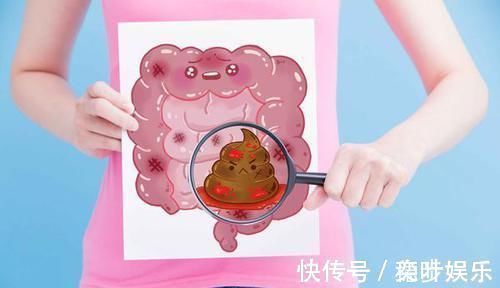 大便|排便不畅,是肠癌吗?医生:符合3个标准,尽早去医院检查一下