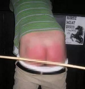 肾衰|9岁男孩排不出尿,查出肾衰,医生说孩子这几处不能随便打