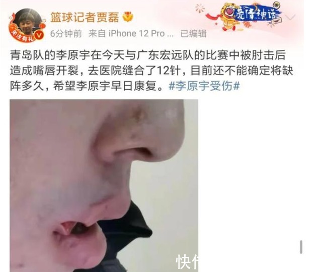 嘲讽|有意思!任骏飞打伤李原宇后,京媒再现嘲讽语气:肯定不是故意的