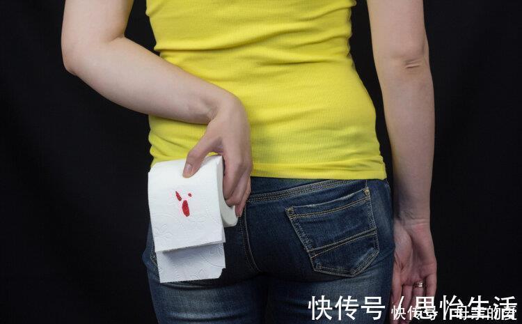 痔疮|屁股出现3大症状,痔疮需要治疗了!试试6招,帮你解决痔疮问题