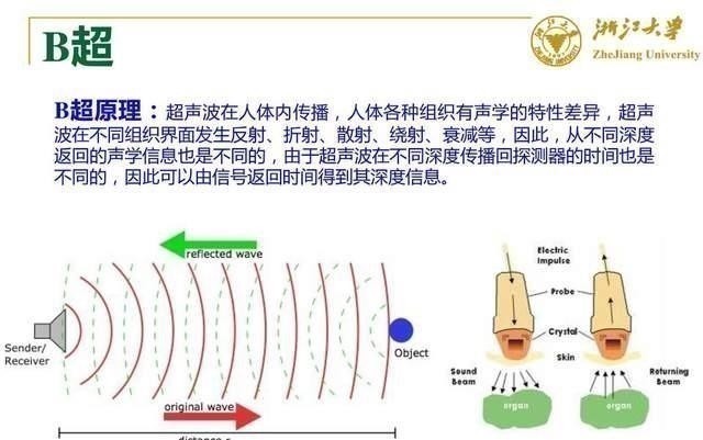 伦琴|做B超前涂的那层黏黏的、凉凉的液体是什么?做完要马上洗掉吗?